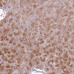 CNPY1 Antibody in Immunohistochemistry (Paraffin) (IHC (P))