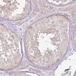 CNPY1 Antibody in Immunohistochemistry (Paraffin) (IHC (P))