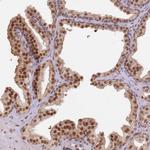 PHC2 Antibody in Immunohistochemistry (Paraffin) (IHC (P))