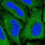 SLC38A5 Polyclonal Antibody