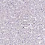 SLC38A5 Antibody in Immunohistochemistry (Paraffin) (IHC (P))