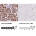 SLC38A5 Antibody in Immunohistochemistry (Paraffin) (IHC (P))