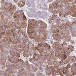 SLC38A5 Antibody in Immunohistochemistry (Paraffin) (IHC (P))