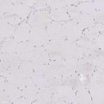 SLC38A5 Antibody in Immunohistochemistry (Paraffin) (IHC (P))