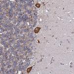 TPST1 Polyclonal Antibody