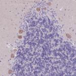 PIGM Polyclonal Antibody