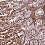 TOPAZ1 Polyclonal Antibody