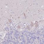 C3orf80 Antibody in Immunohistochemistry (Paraffin) (IHC (P))