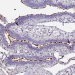 C3orf80 Antibody in Immunohistochemistry (Paraffin) (IHC (P))