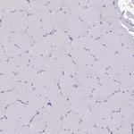 C3orf80 Antibody in Immunohistochemistry (Paraffin) (IHC (P))