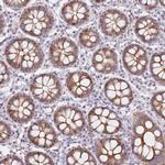 C10orf11 Antibody in Immunohistochemistry (Paraffin) (IHC (P))