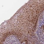 C10orf11 Antibody in Immunohistochemistry (Paraffin) (IHC (P))