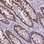 RIPPLY2 Polyclonal Antibody