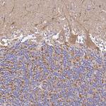 OR2B11 Antibody in Immunohistochemistry (Paraffin) (IHC (P))