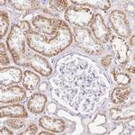OR2B11 Antibody in Immunohistochemistry (Paraffin) (IHC (P))