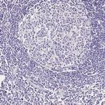 OR2B11 Polyclonal Antibody