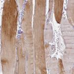 OR2B11 Antibody in Immunohistochemistry (Paraffin) (IHC (P))