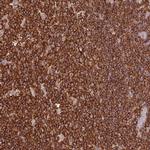 OR6P1 Polyclonal Antibody