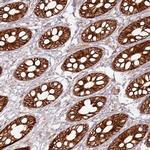 TLDC2 Polyclonal Antibody