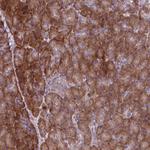 C20orf27 Antibody in Immunohistochemistry (Paraffin) (IHC (P))