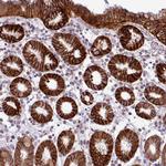 C20orf27 Antibody in Immunohistochemistry (Paraffin) (IHC (P))