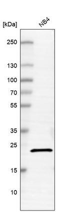 C20orf27 Antibody in Western Blot (WB)