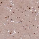 SH3BGRL2 Antibody in Immunohistochemistry (Paraffin) (IHC (P))
