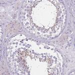 PDHA2 Antibody in Immunohistochemistry (Paraffin) (IHC (P))