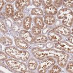 TPD52L2 Antibody in Immunohistochemistry (Paraffin) (IHC (P))