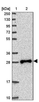 TPD52L2 Antibody in Western Blot (WB)