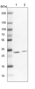 TPD52L2 Antibody in Western Blot (WB)
