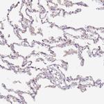 HSD17B7 Polyclonal Antibody