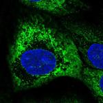 PVRIG Antibody in Immunocytochemistry (ICC/IF)
