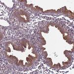 PVRIG Antibody in Immunohistochemistry (Paraffin) (IHC (P))