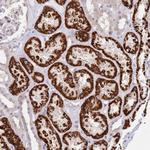 PVRIG Antibody in Immunohistochemistry (Paraffin) (IHC (P))