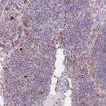 PVRIG Antibody in Immunohistochemistry (Paraffin) (IHC (P))