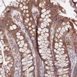 PVRIG Antibody in Immunohistochemistry (Paraffin) (IHC (P))