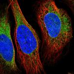 VRK2 Polyclonal Antibody