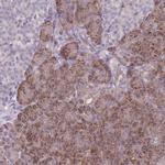 VRK2 Antibody in Immunohistochemistry (IHC)