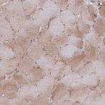 VRK2 Antibody in Immunohistochemistry (IHC)