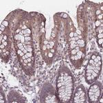 VRK2 Antibody in Immunohistochemistry (IHC)