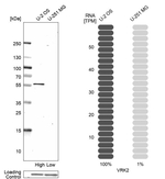 VRK2 Antibody in Western Blot (WB)