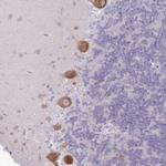 OR5L1/OR5L2 Antibody in Immunohistochemistry (Paraffin) (IHC (P))
