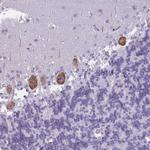 OR6B2 Polyclonal Antibody