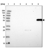 GGT2 Antibody in Western Blot (WB)