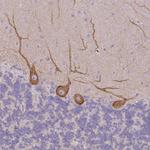 MYH10 Polyclonal Antibody