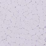 MYH10 Antibody in Immunohistochemistry (IHC)