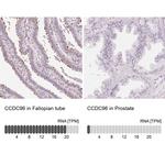 CCDC96 Polyclonal Antibody