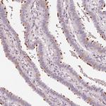 CCDC96 Antibody in Immunohistochemistry (IHC)