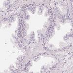 CCDC96 Antibody in Immunohistochemistry (IHC)